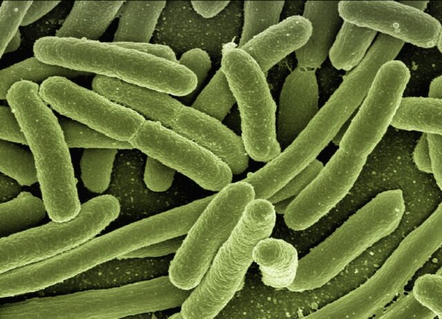 Cómo limpiar Ipad-Bacteria